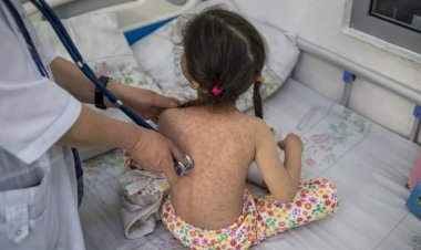 Rebrote de sarampión exhibe abandono federal: Pedro Pérez